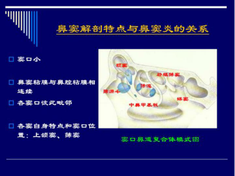 鼻和鼻窦CT解剖课件.ppt_第2页