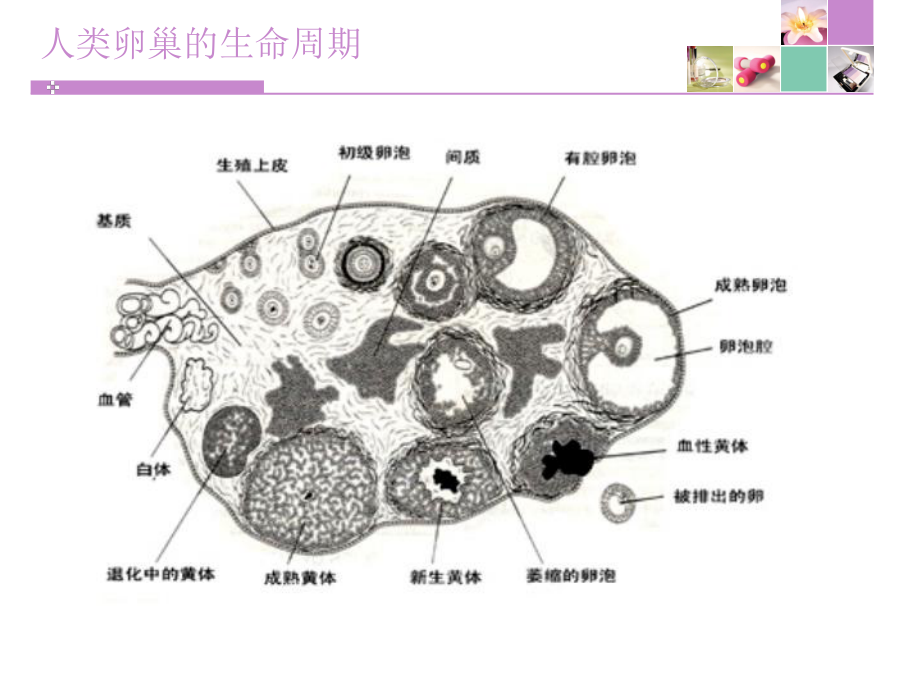 黄体破裂(杂)课件.ppt_第3页