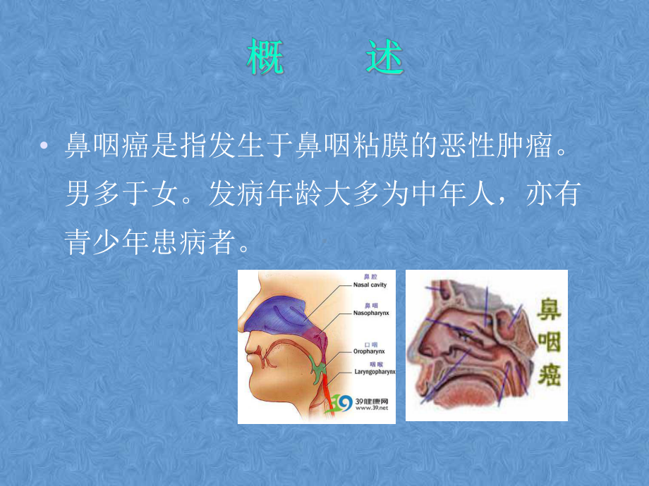 鼻咽癌患者放疗的护理课件.ppt_第3页