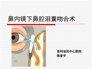 鼻内镜鼻腔泪囊吻合术课件.ppt