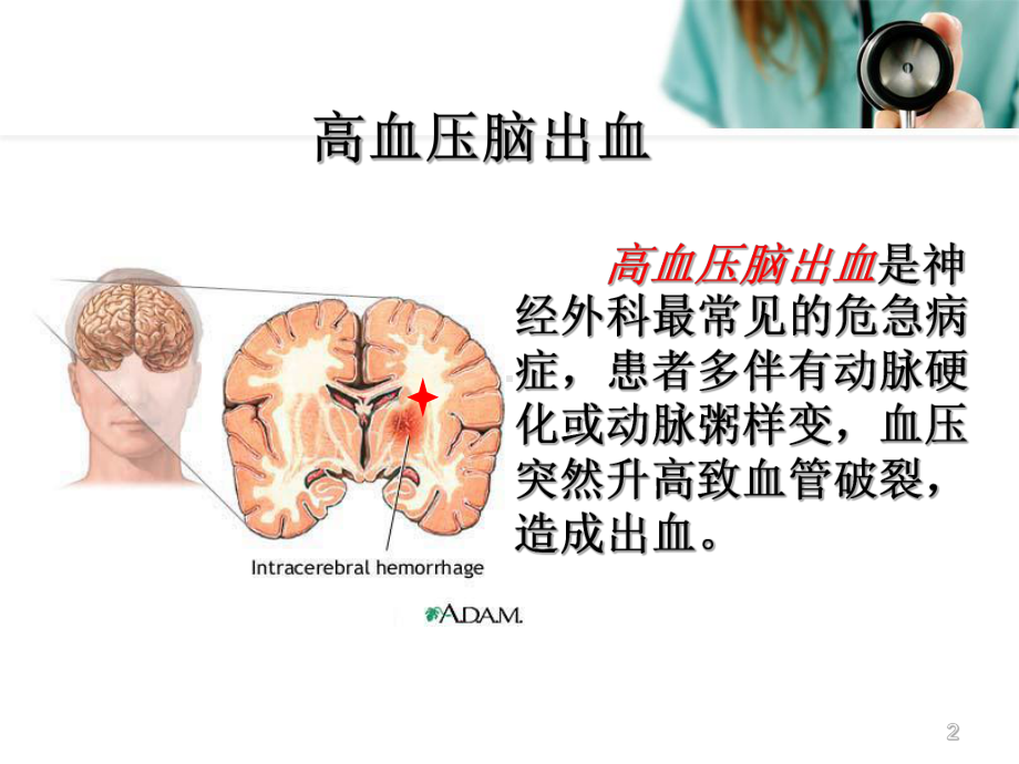 高血压脑出血健康教育参考课件.ppt_第2页