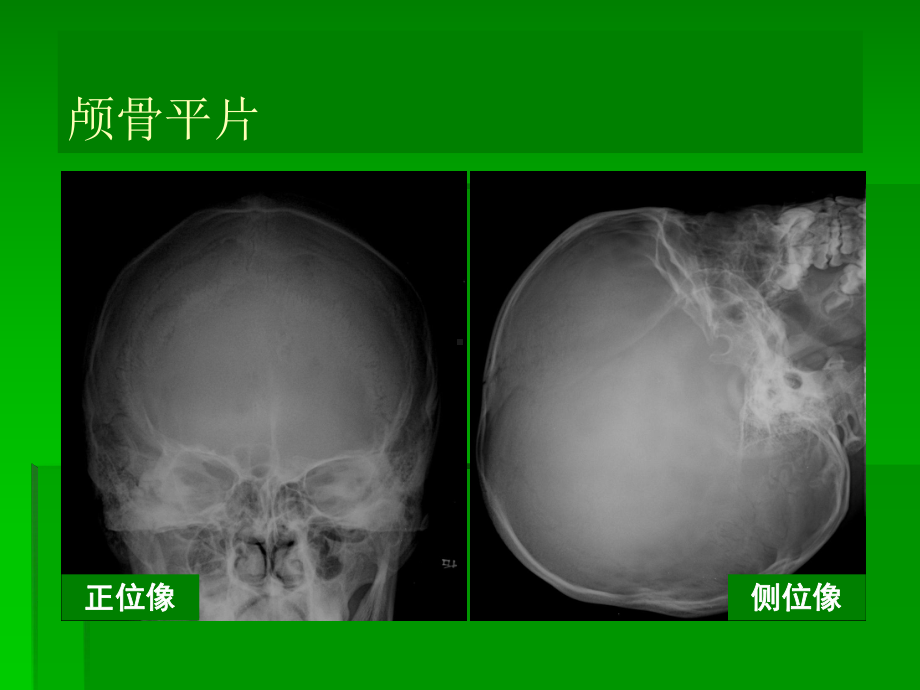 中枢神经系统总论医学课件.ppt_第3页