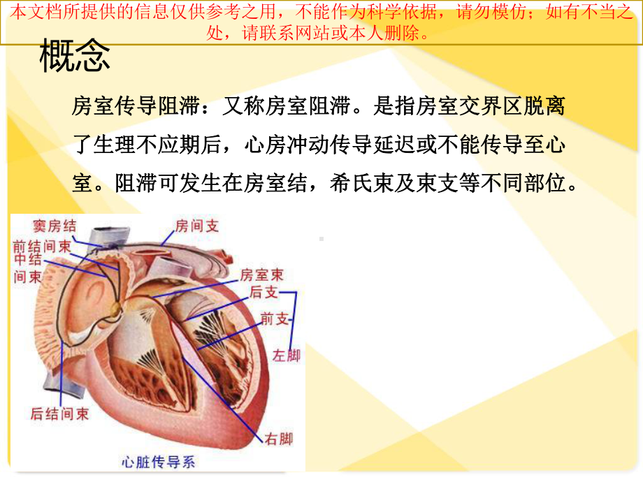 三度房室传导阻滞医疗护理查房培训课件.ppt_第2页