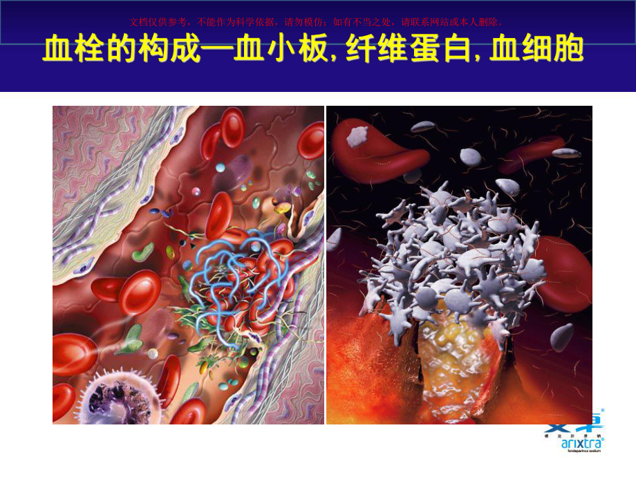 ACS抗凝治疗新观点课件.ppt_第2页