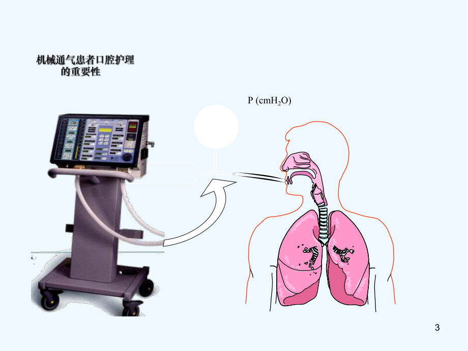 专科口腔护理课件.ppt_第3页