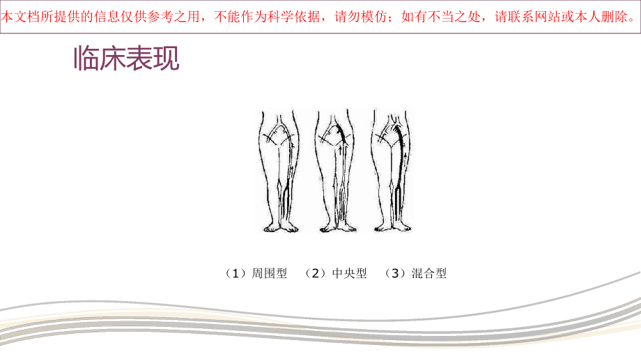 下肢深静脉血栓的预防和医疗护理培训课件.ppt_第3页