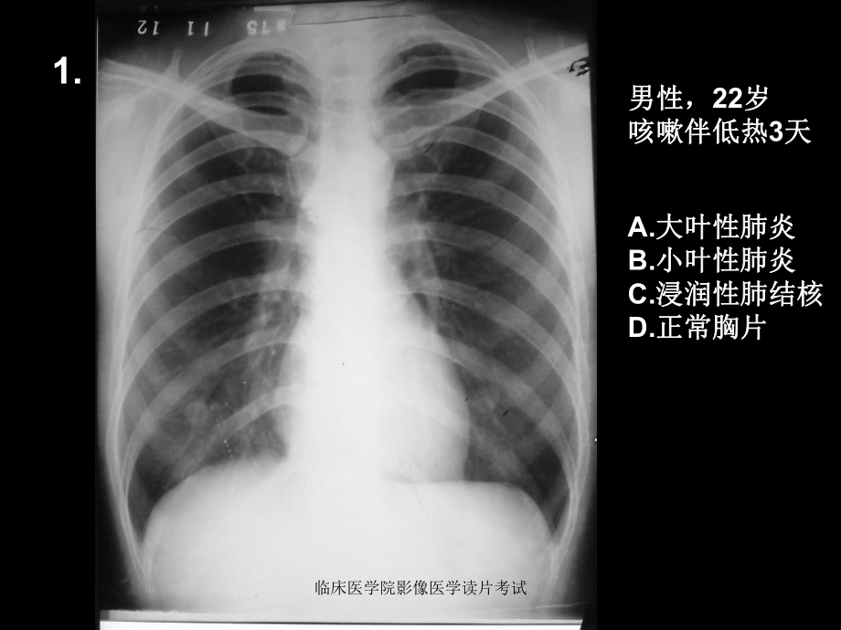 临床医学院影像医学读片考试课件.ppt_第2页