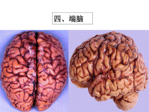 系统解剖学-大脑课件.ppt