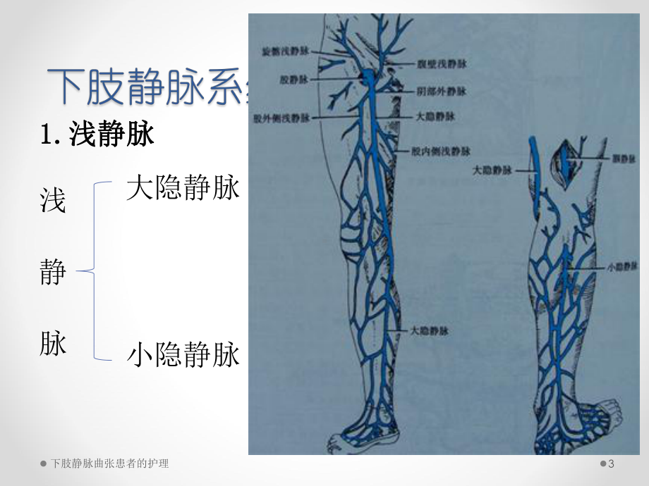 下肢静脉曲张患者的护理课件.pptx_第3页