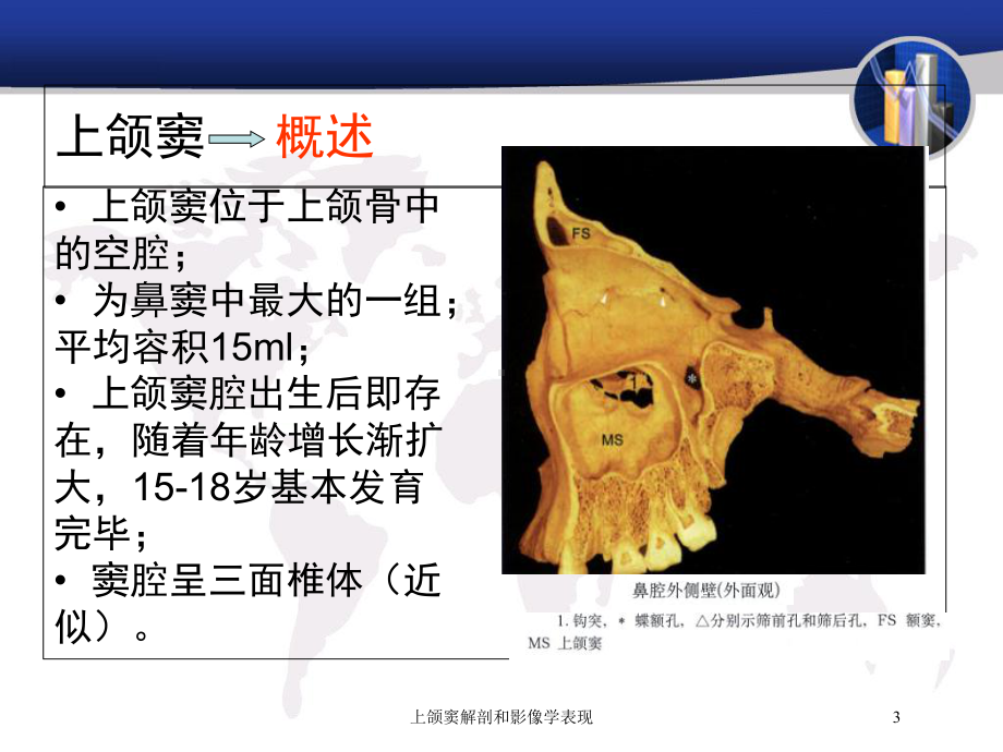 上颌窦解剖和影像学表现培训课件.ppt_第3页