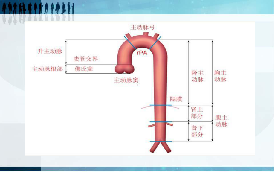 主动脉夹层影像学分析-课件.ppt_第3页