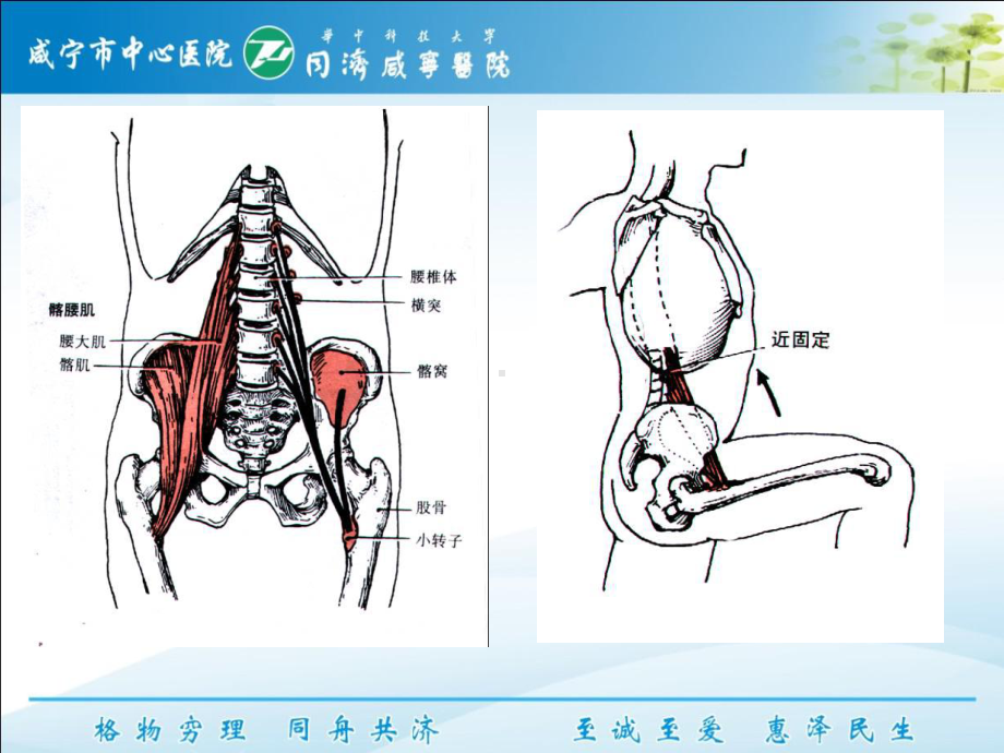 下交叉综合征-课件.ppt_第3页