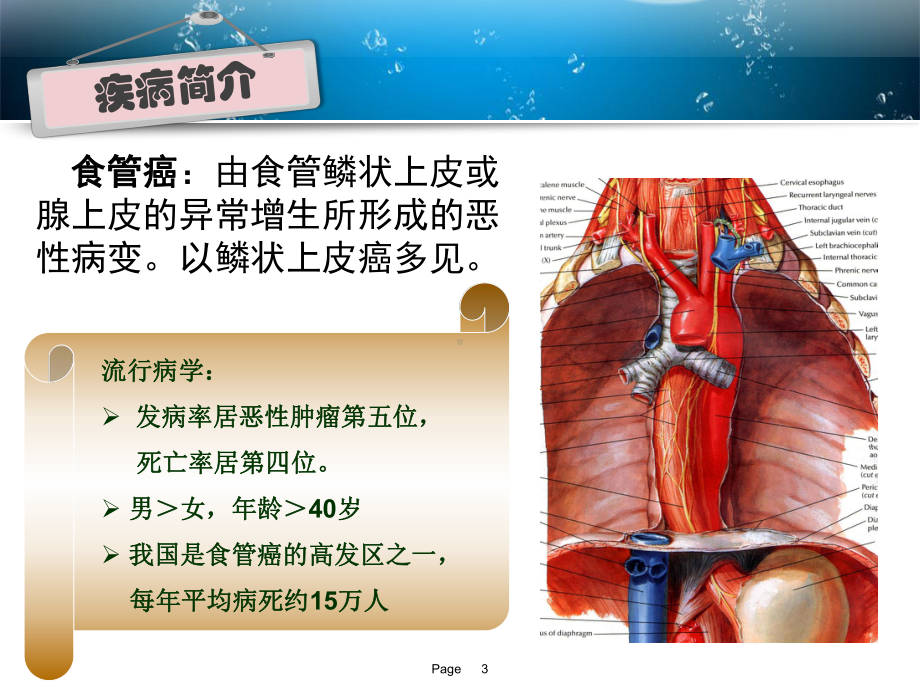 一例晚期食管癌患者的药学监护课件.ppt_第3页