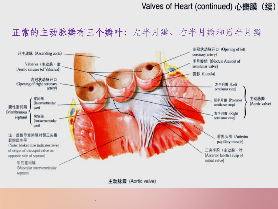 18床Bentall手术护理查房课件-2.ppt_第2页