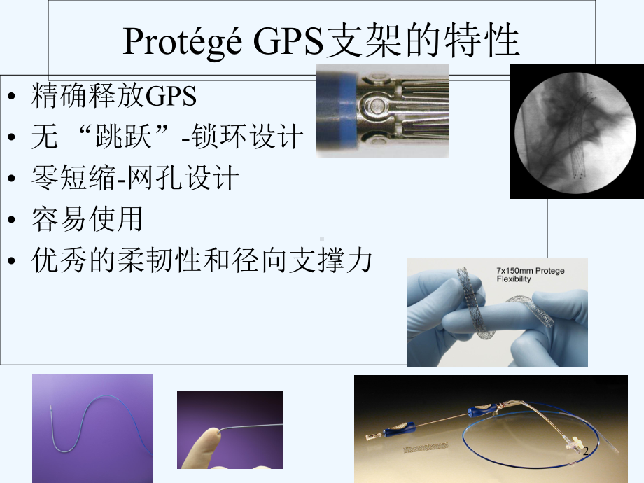 Ev3颈动脉支架和保护伞-课件.ppt_第2页