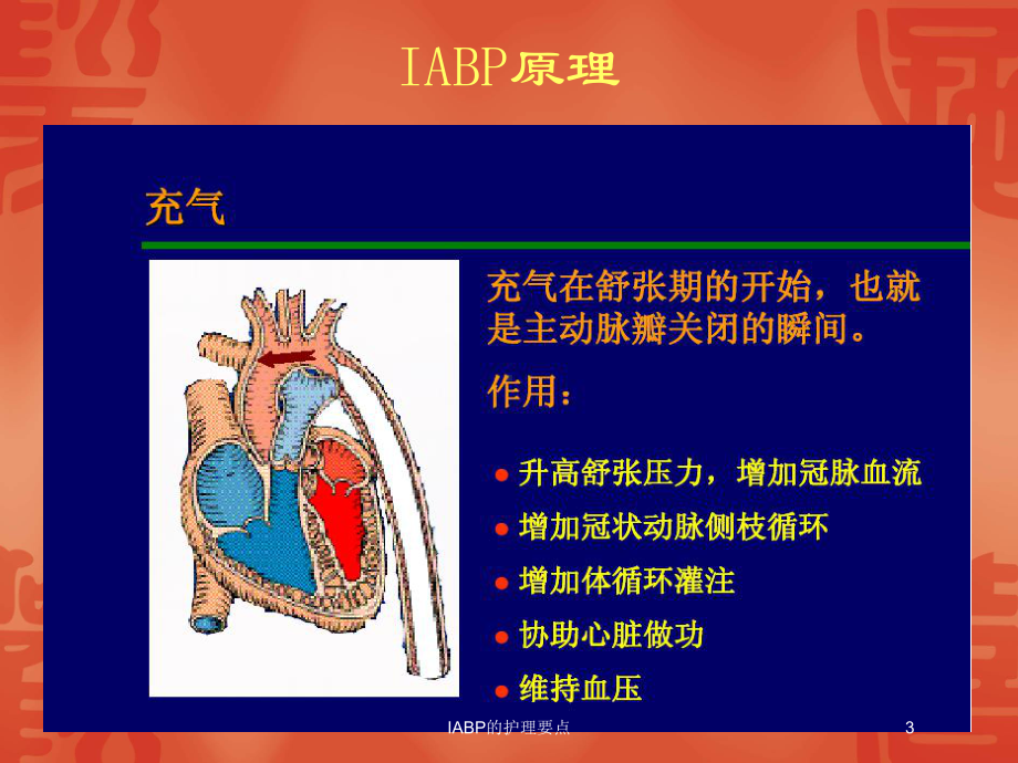 IABP的护理要点培训课件.ppt_第3页