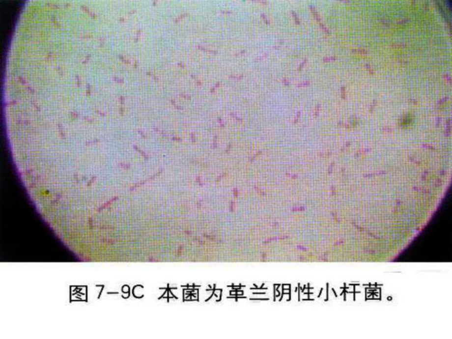 dd细菌性痢疾哈医大二院感染病科高杰课件.pptx_第3页