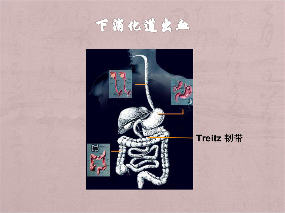 下消化道出血诊治课件.ppt_第2页