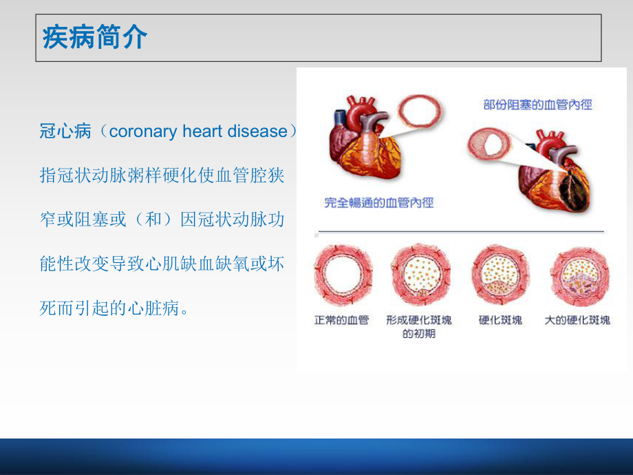 一例急性非ST段抬高型心梗合并感染患者的病例分析课件.ppt_第3页