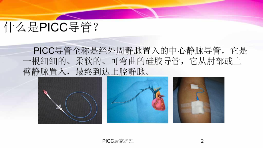 PICC居家护理培训课件.ppt_第2页