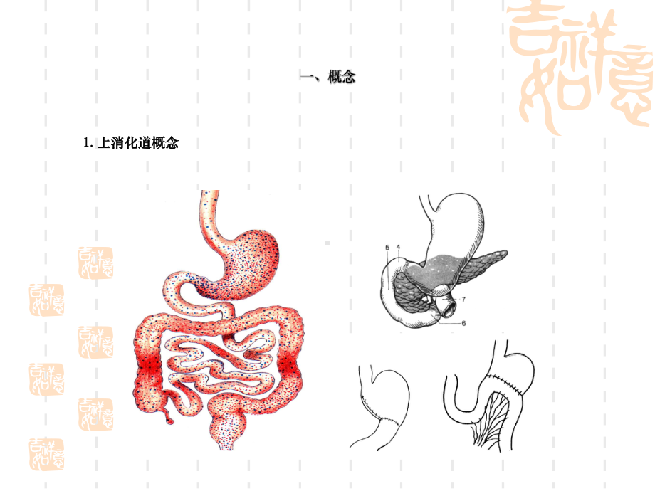 xxxttt上消化道出血课件.ppt_第3页