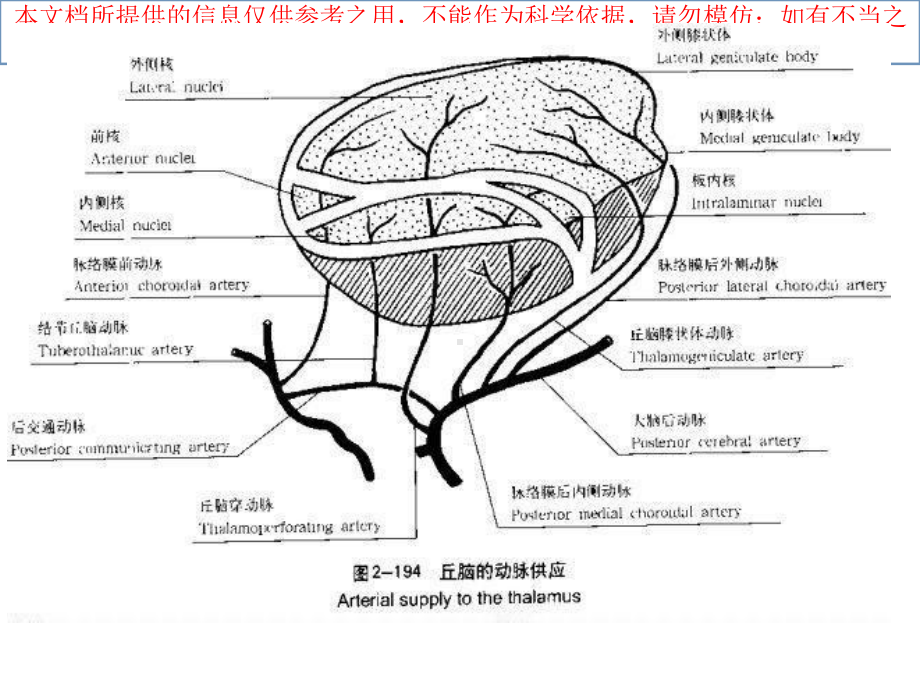 丘脑供血动脉和丘脑梗死培训课件.ppt_第3页