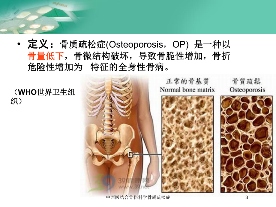 中西医结合骨伤科学骨质疏松症培训课件.ppt_第3页