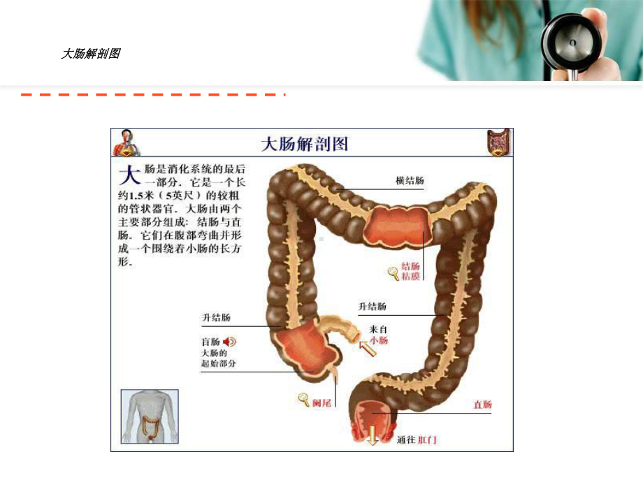 个案分析直肠癌课件.ppt_第3页