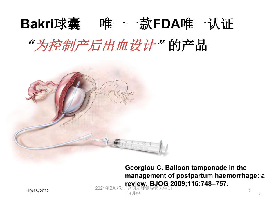 2021年BAKRI子宫填塞球囊导管医学知识讲解课件.ppt_第2页