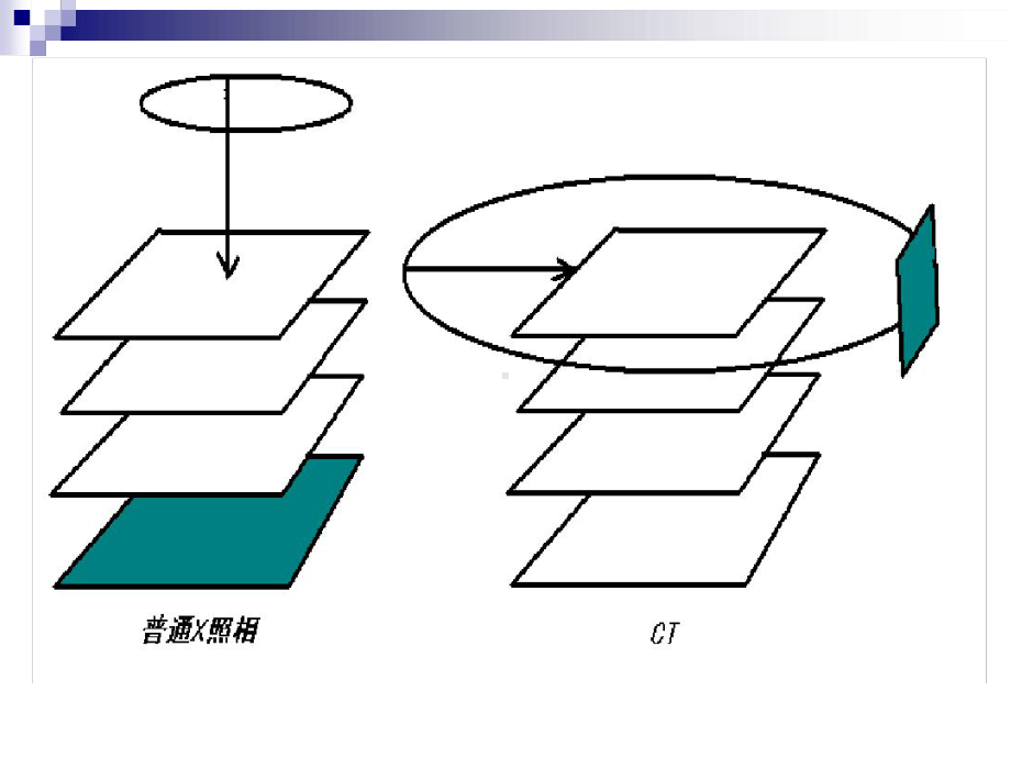 CT设备原理-课件.ppt_第3页