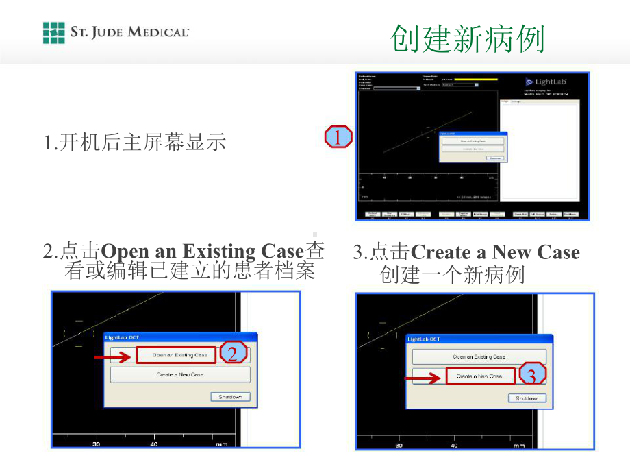 OCTC快速操作和测量指南培训课件.ppt_第3页