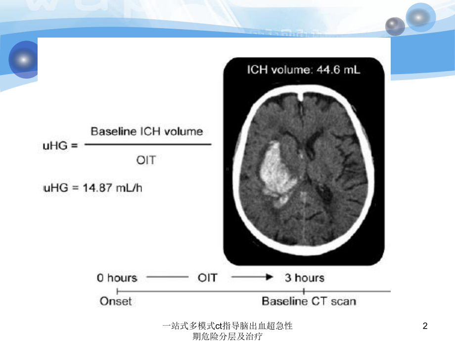 一站式多模式ct指导脑出血超急性期危险分层及治疗课件.pptx_第2页