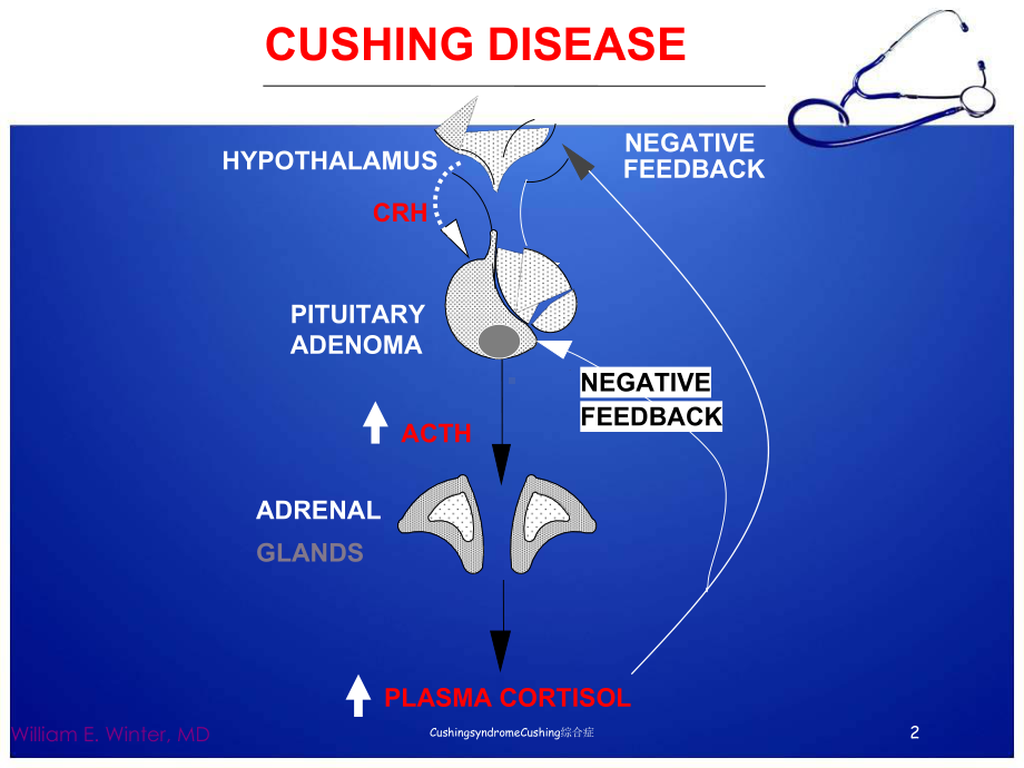 CushingsyndromeCushing综合症培训课件.ppt_第2页