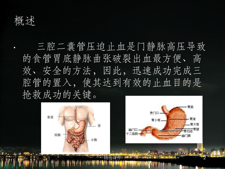 三腔二囊管的应用和护理55881课件.ppt_第2页