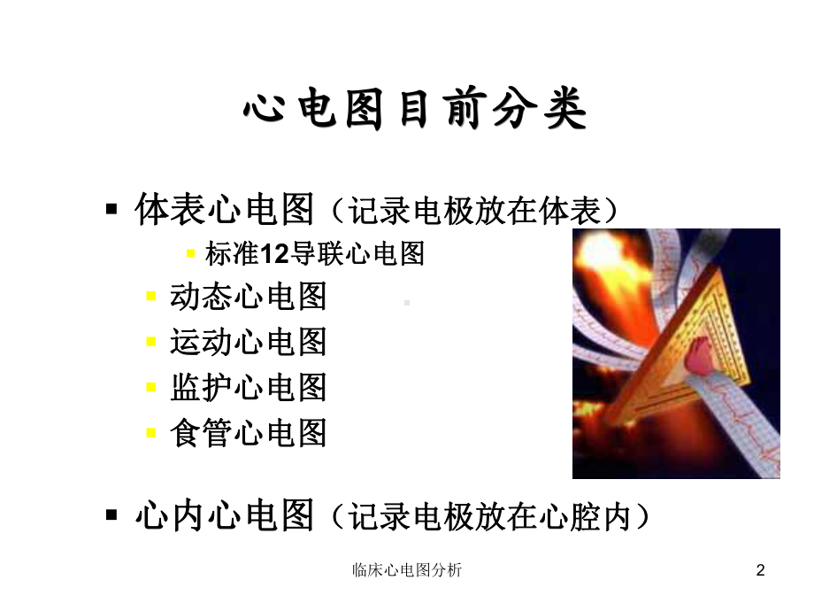 临床心电图分析课件.ppt_第2页