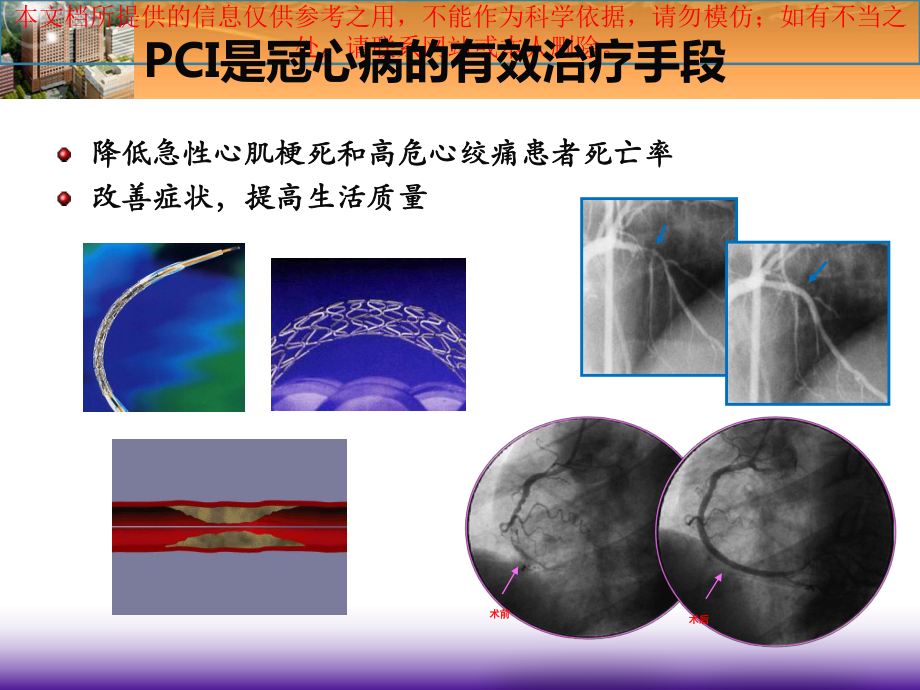 PCI术后心脏康复共识培训课件.ppt_第3页