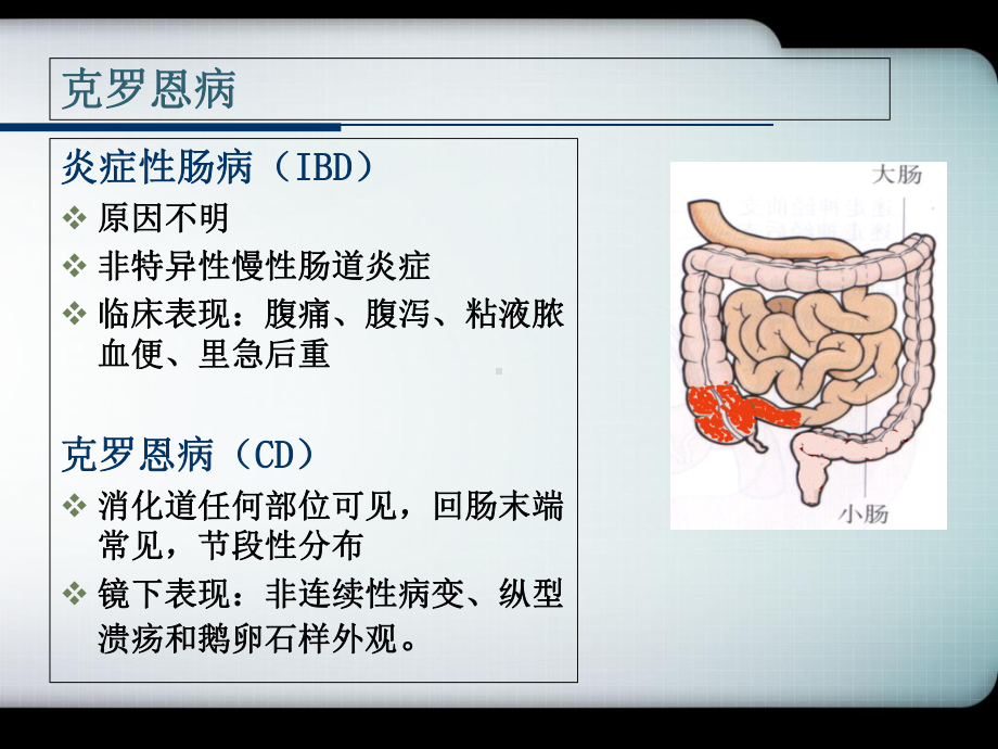 一例克罗恩病患者的用药监护课件.ppt_第2页