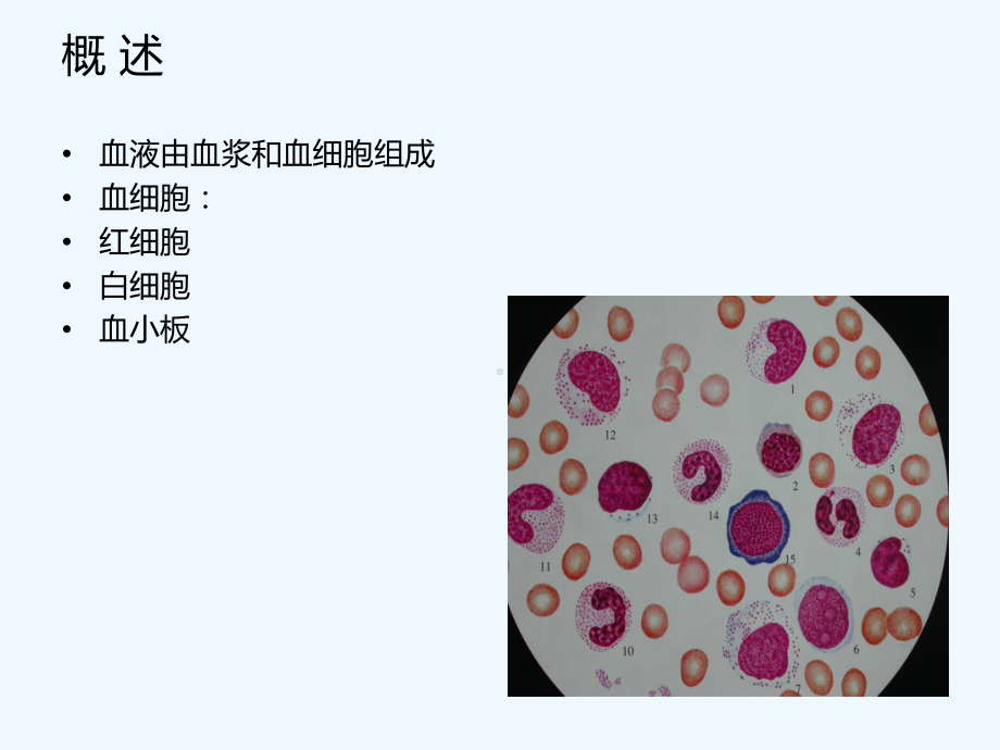 中西结合治疗再生障碍性贫血的概况课件.ppt_第3页