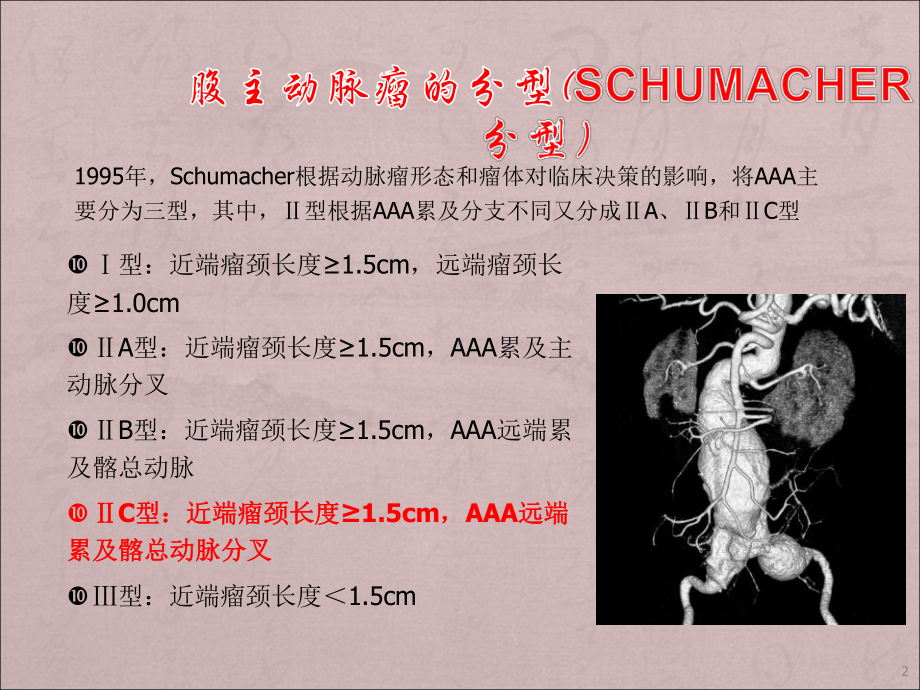 IIC腹主动脉瘤腔内修复中髂内动脉的处理课件.ppt_第2页