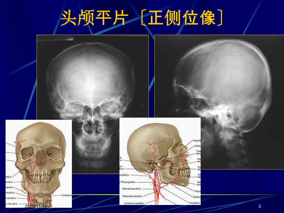 中枢神经系统正常及异常影像改变课件.ppt_第3页