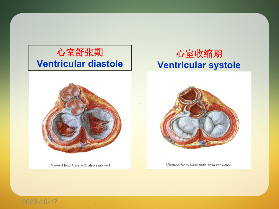 18床Bentall手术护理查房课件.ppt_第3页