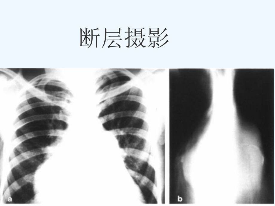 jian影像诊断学循环系统课件.ppt_第2页