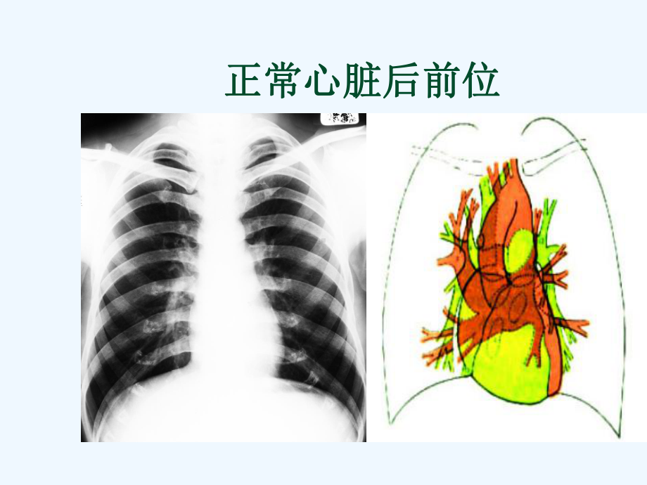 jian影像诊断学循环系统课件.ppt_第3页