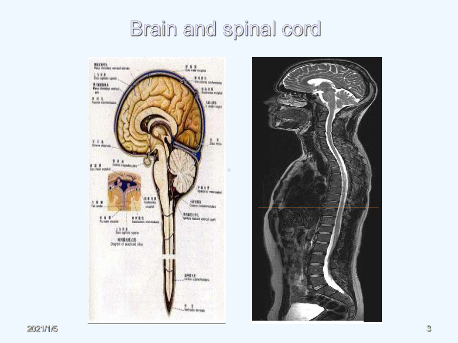 中枢神经系统影像诊断一课件.ppt_第3页