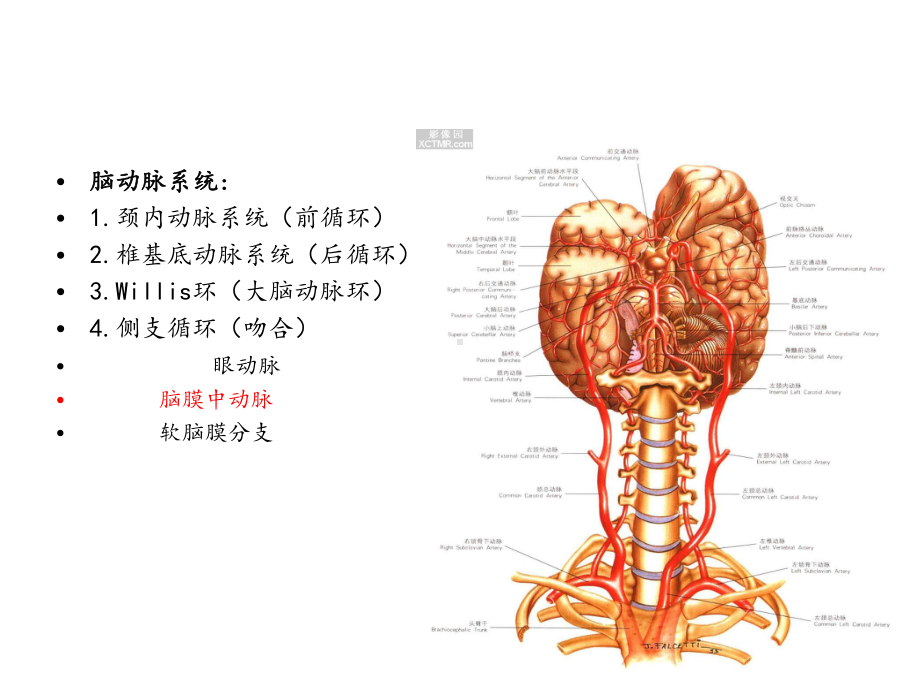 穿支动脉梗死课件.ppt_第3页