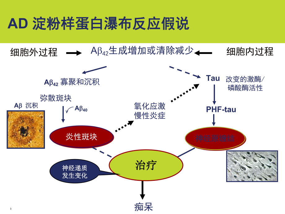 AD治疗新进展参考课件.ppt_第3页