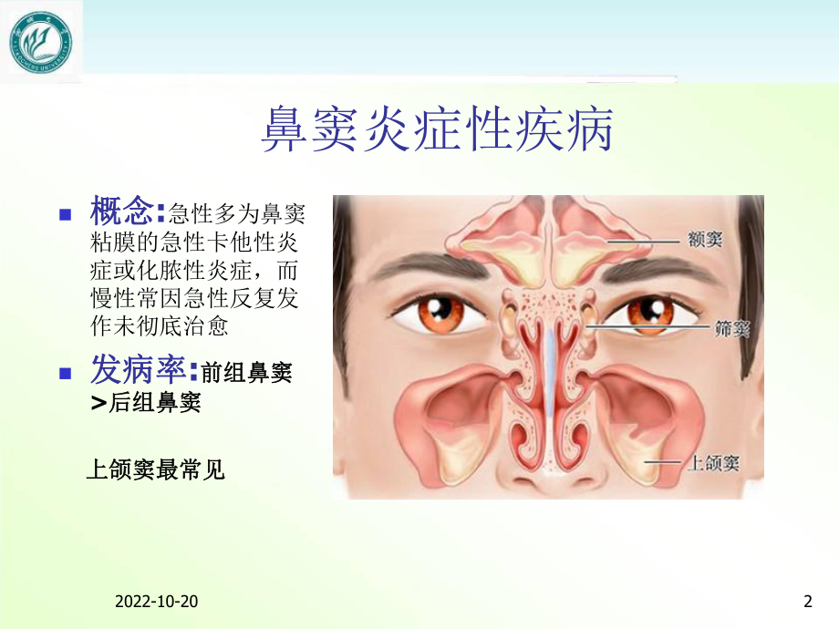 《耳鼻咽喉头颈外科学》急慢性鼻窦炎-课件.ppt_第2页