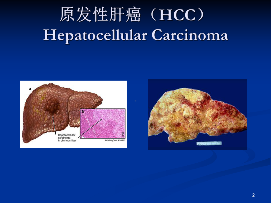 HCCCT技术与诊断指南课件.ppt_第2页