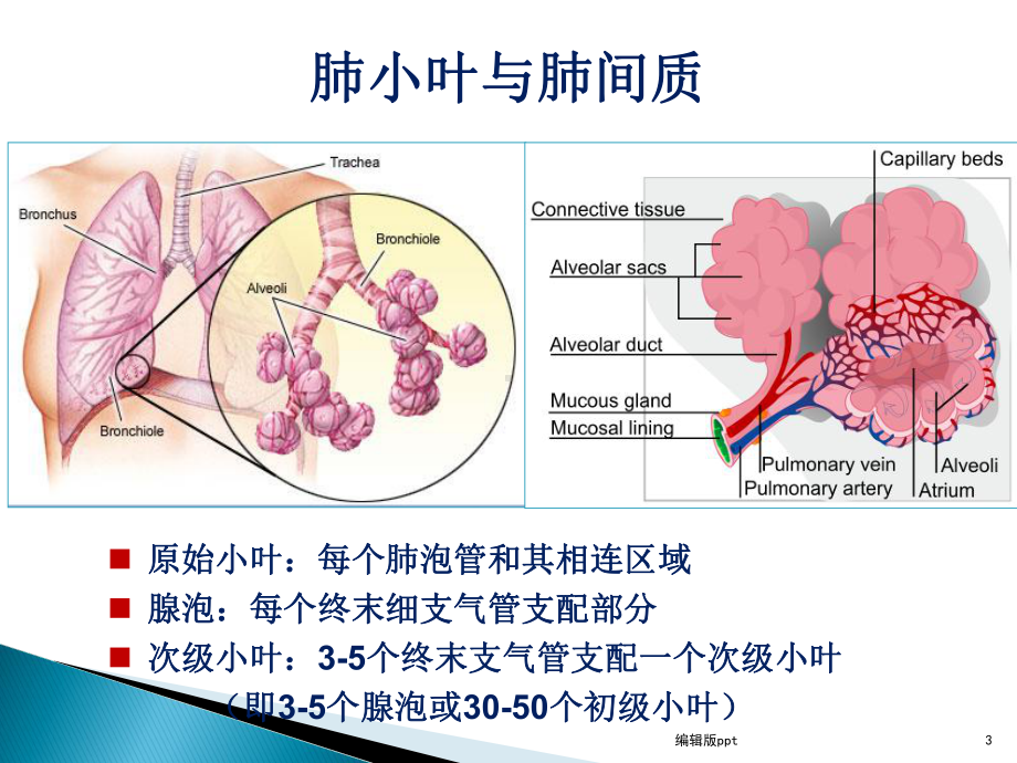 ILD分类与诊断课件.ppt_第3页