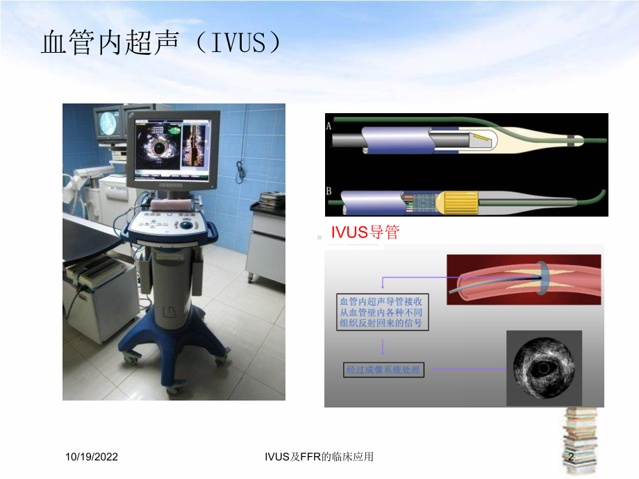 IVUS及FFR的临床应用课件.ppt_第2页